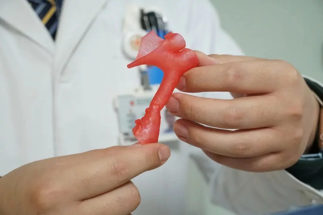 硬核！“3D打印时代”到来，医院如何打印一颗心脏「详细解答」(图7)